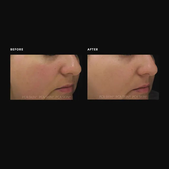 Dual Action Redness Relief