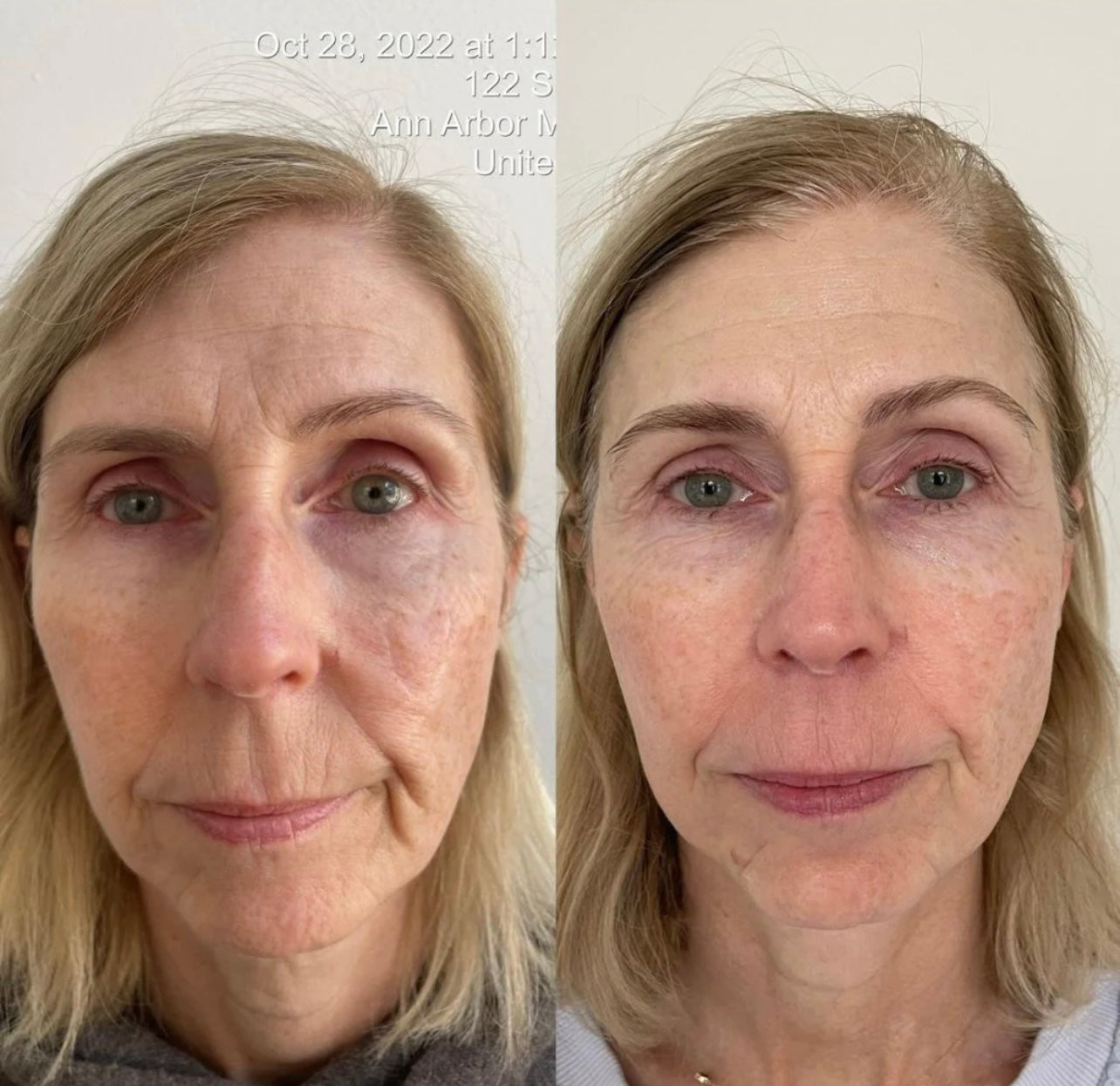 Youthplex Face Lift Serum