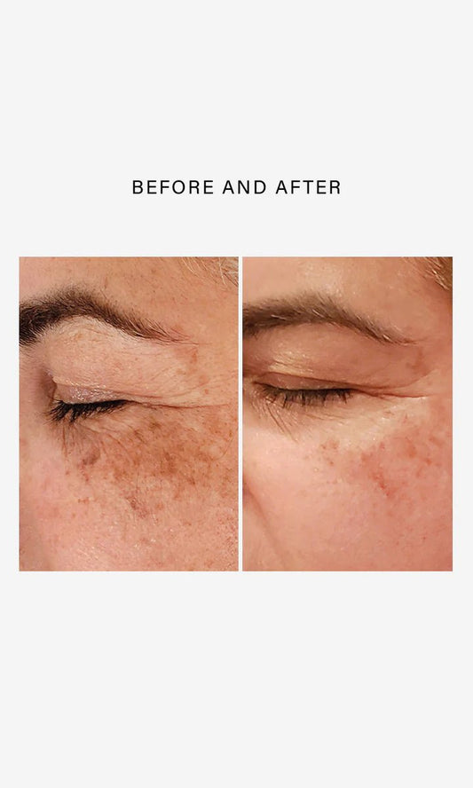 FF3 Triple Repair Complex - Amethyst Skin Clinic