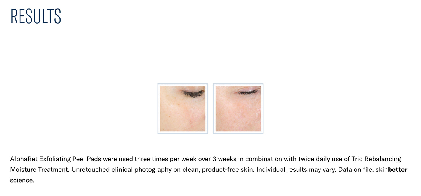 AlphaRet Exfoliating Peel Pads