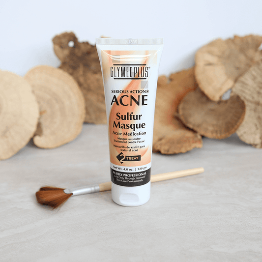 Acne Mattifying Sulfur Masque - Amethyst Skin Clinic