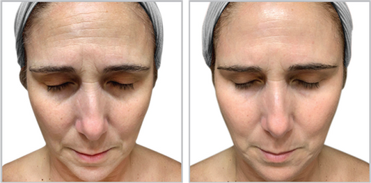 Biointensive Growth Factor FF3