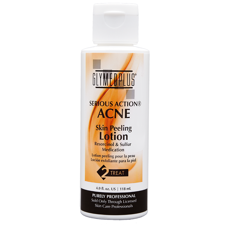 Acne Skin Peeling Lotion/Resurfacing Lotion