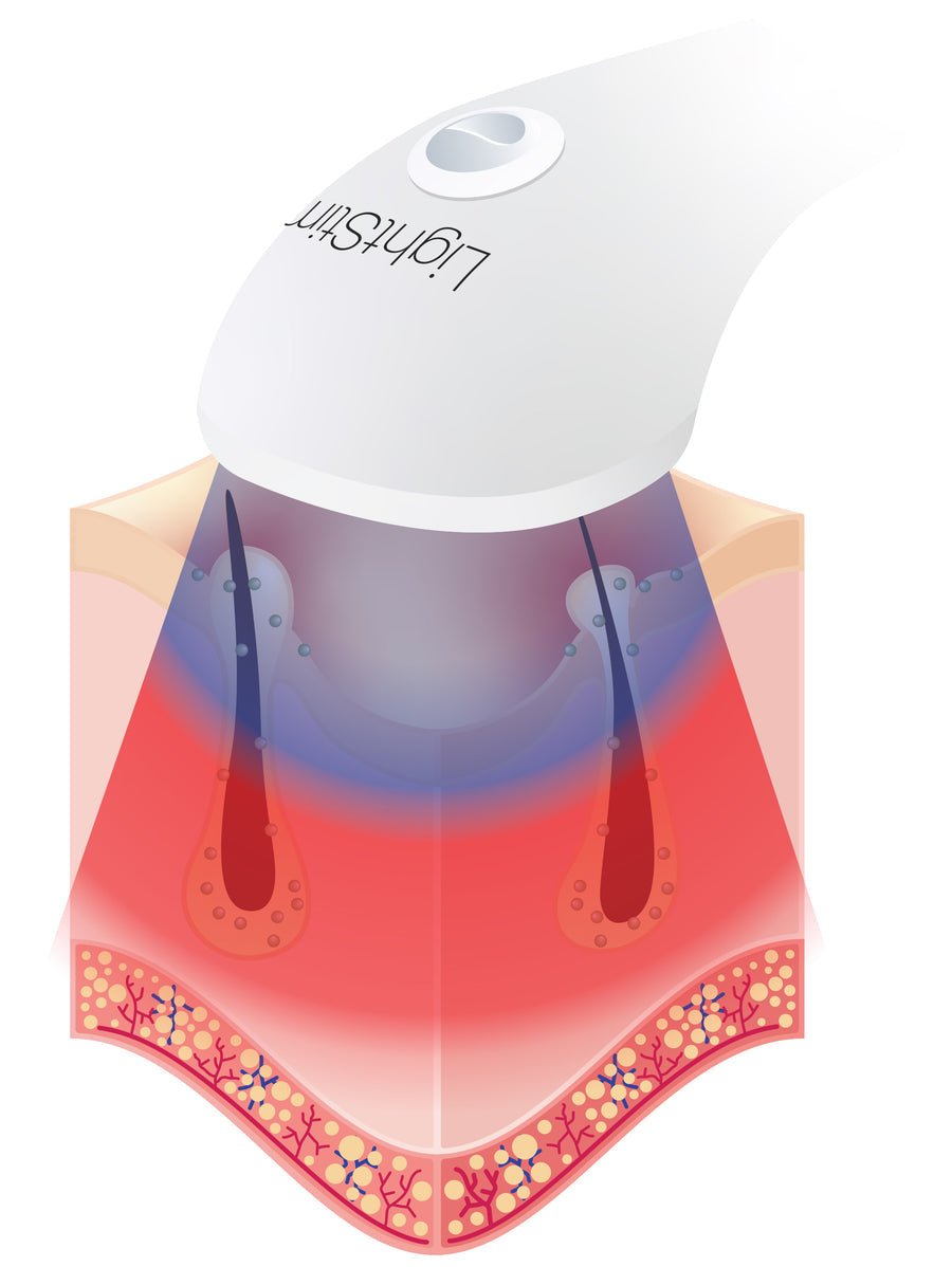 Revolutionize Your Skin: The Power of LightStim LED Light Therapy - Amethyst Skin Clinic