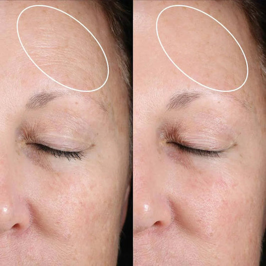 Skinbetter Science Celebrates 10 Transformative Years With Laura Love - Amethyst Skin Clinic