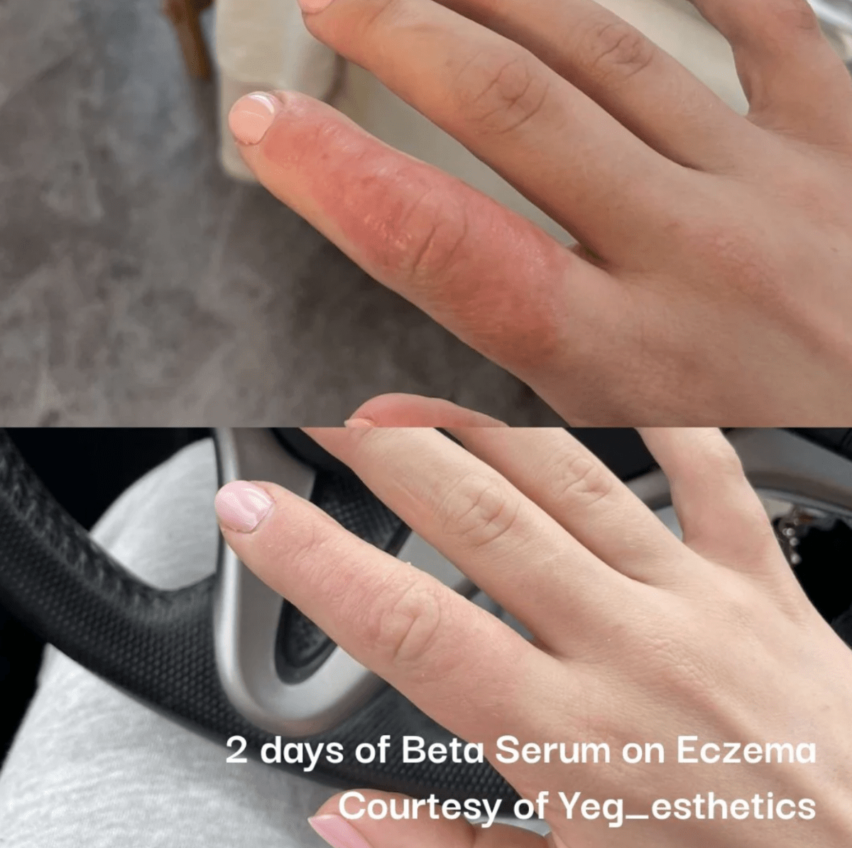 Beta - Glucan Serum - Amethyst Skin Clinic