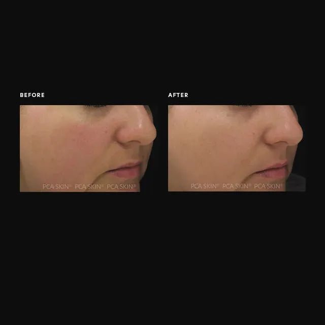 Dual Action Redness Relief - Amethyst Skin Clinic