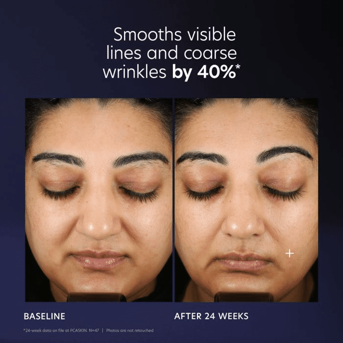 Pro - Max Age Renewal - Amethyst Skin Clinic