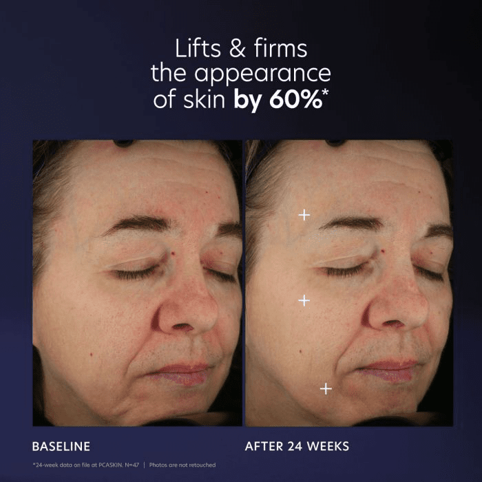 Pro - Max Age Renewal - Amethyst Skin Clinic