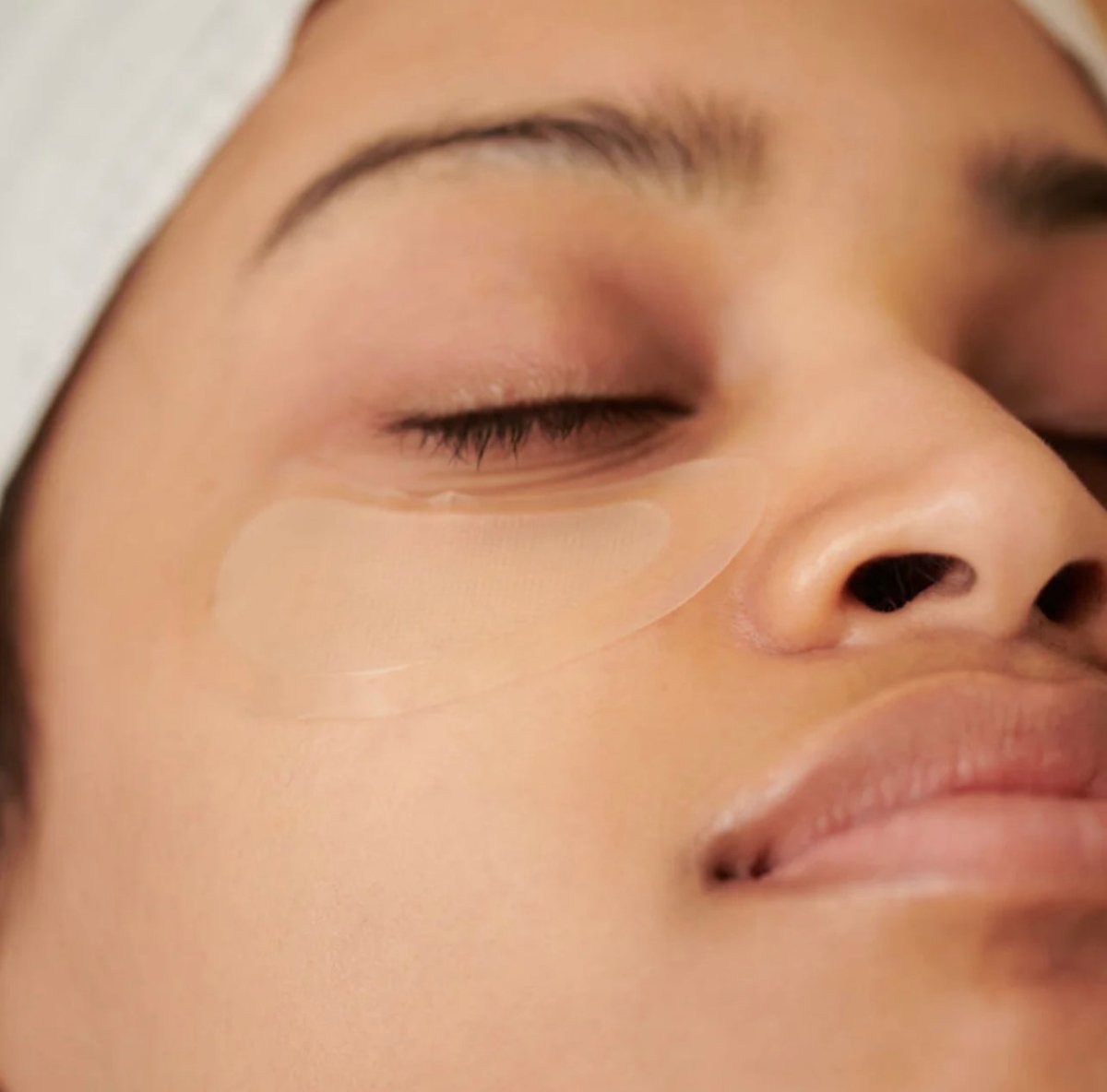 Undereye Darts - Amethyst Skin Clinic