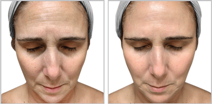 Biointensive Growth Factor FF3 - Amethyst Skin Clinic