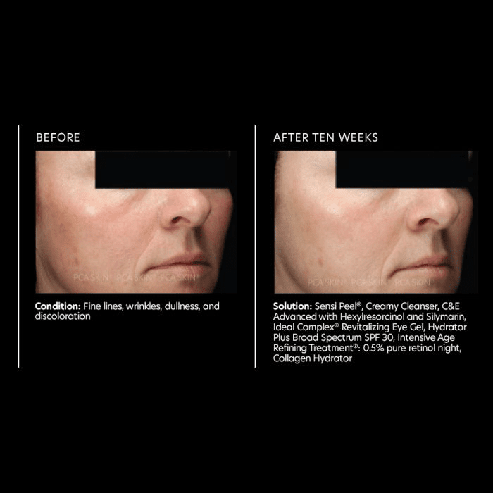 C&E Advanced - Amethyst Skin Clinic