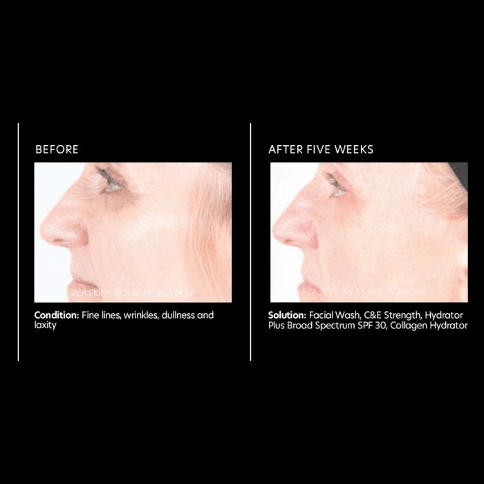 C&E Strength Max - Amethyst Skin Clinic