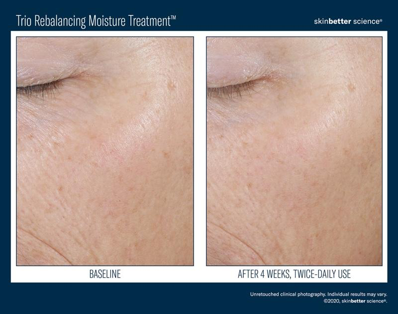 Trio Rebalancing Moisture Treatment 50 ml