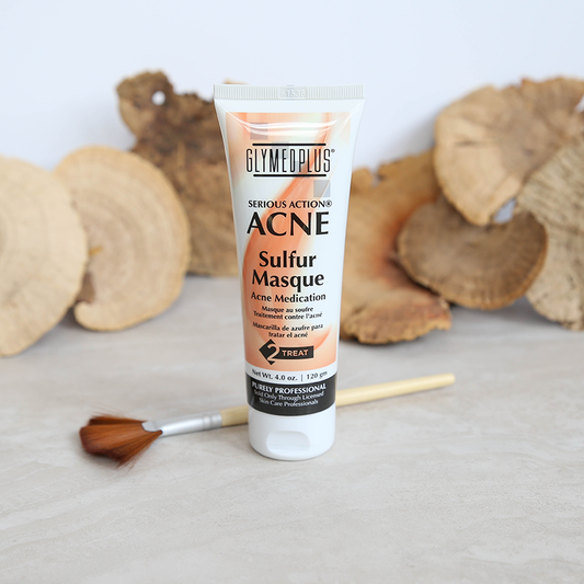 Acne Mattifying Sulfur Masque