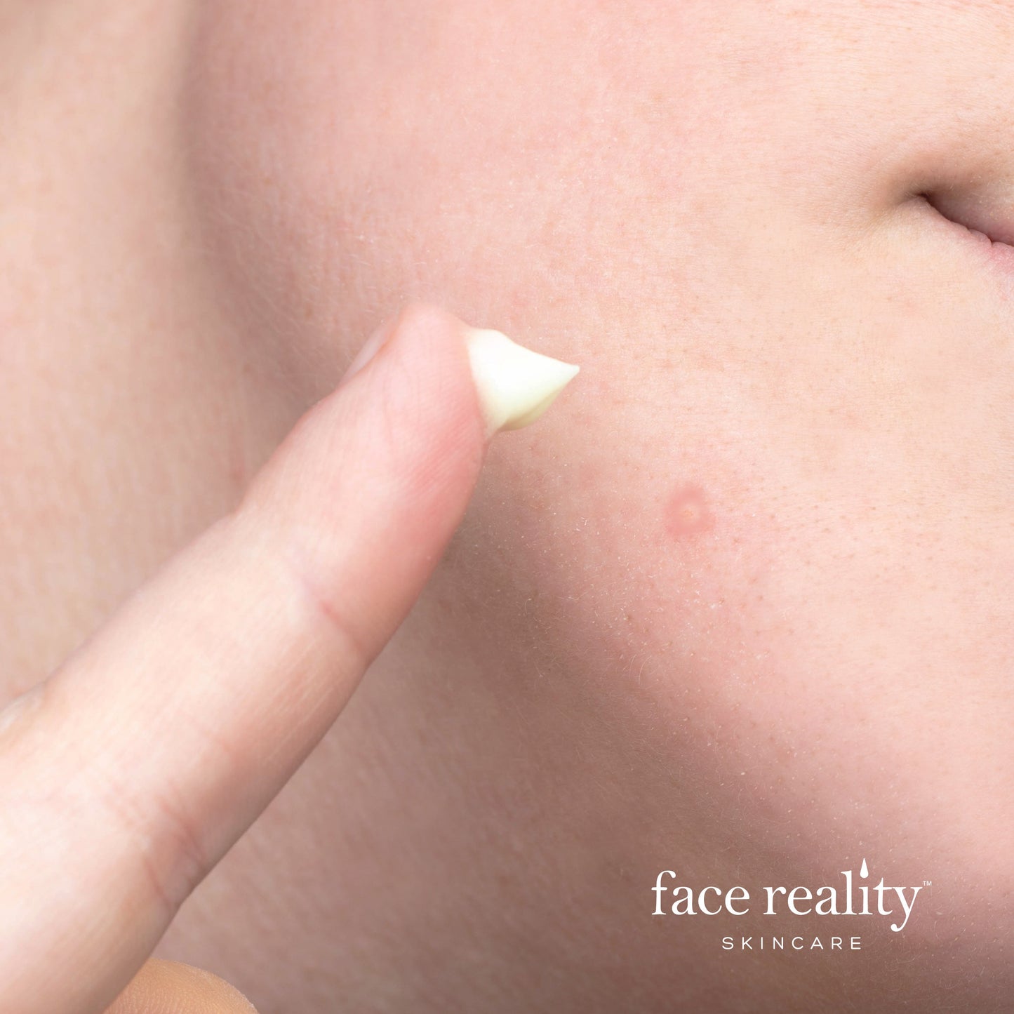 Sulfur Spot Treatment