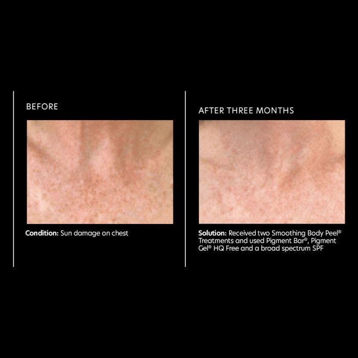 Pigment Bar® - Amethyst Skin Clinic