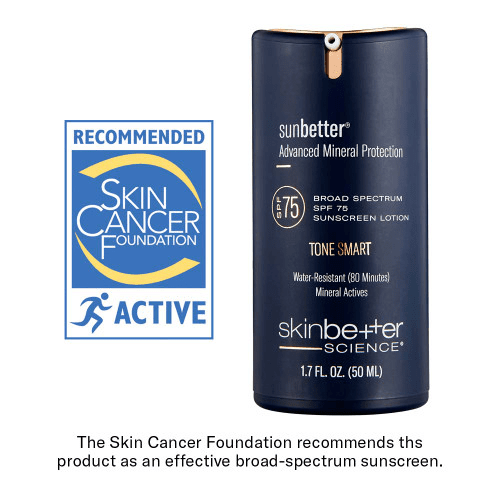 sunbetter TONE SMART SPF 75 Sunscreen Lotion - Amethyst Skin Clinic